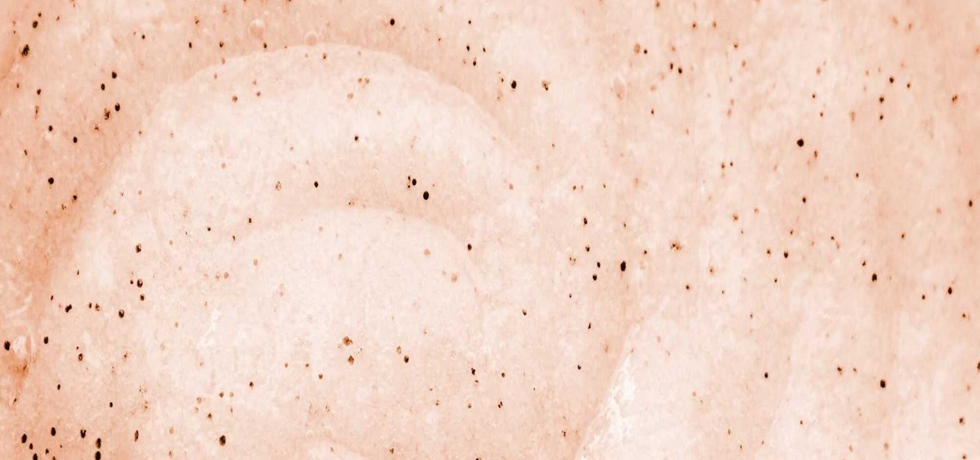 5 Fun Sports to Achieve Radiant Skin