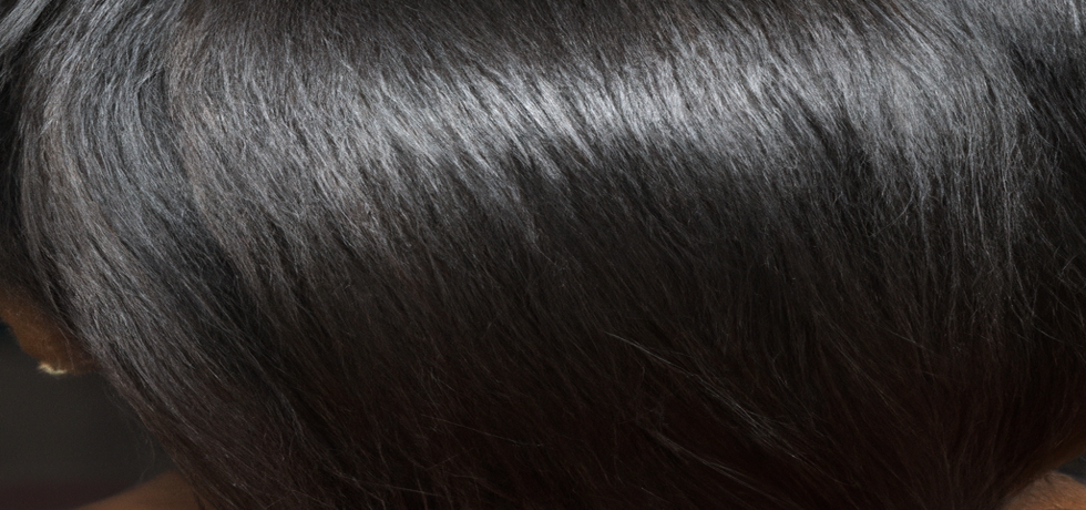 Dandruff: Understanding the Causes & Solutions