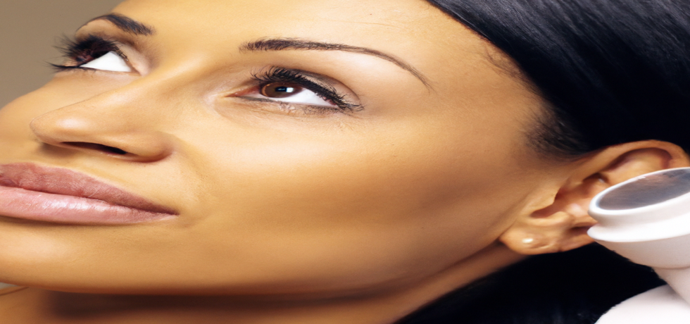 Exploring Advanced Laser Treatments for Melasma