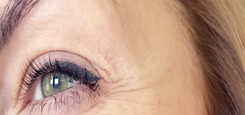 How to Smooth Away Vertical Lines Under Your Eyes