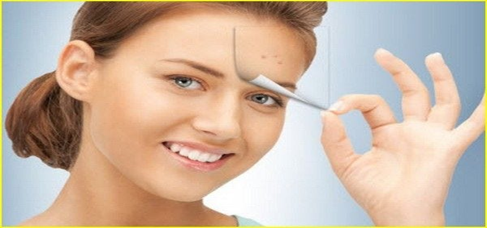 Prevent Age Spots: Effective Strategies for Youthful Skin