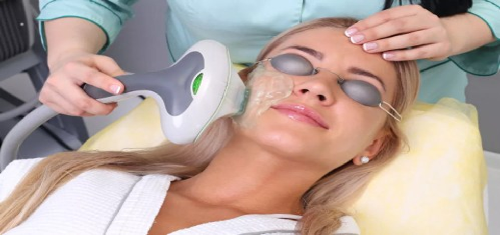 Quick Tips for a Successful Photofacial Recovery