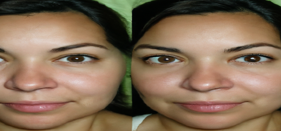 Rejuvenate Your Skin: The Ultimate Anti-Ageing Guide