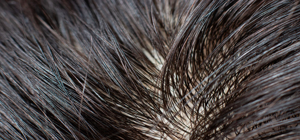 Revitalize Your Mane: A Guide to Managing Oily Hair