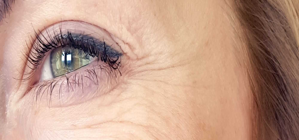 Soothing Solutions for Flare-ups