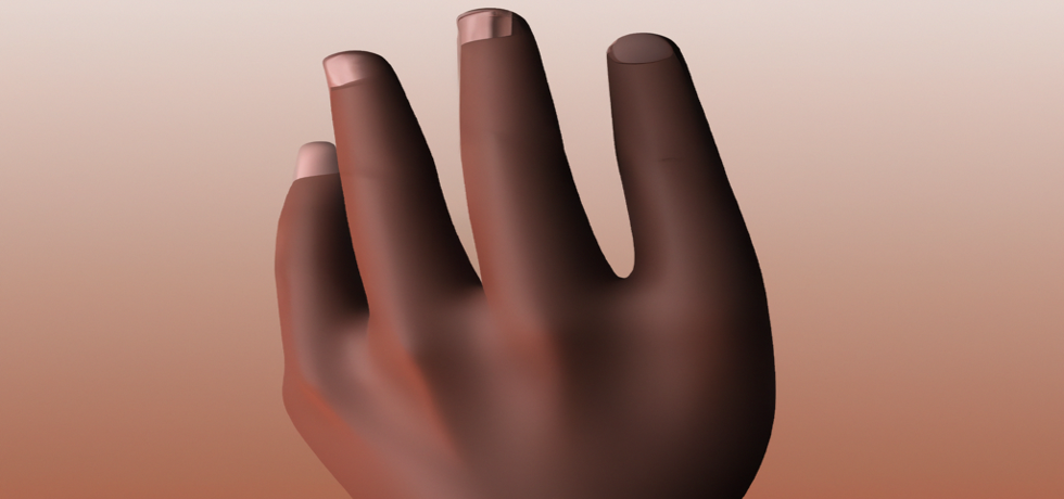 Unveiling Nail Psoriasis: A Comprehensive Guide