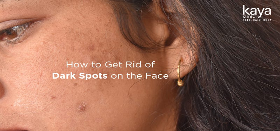 Unveiling Radiant Skin: The Ultimate Guide to Banishing Dark Spots