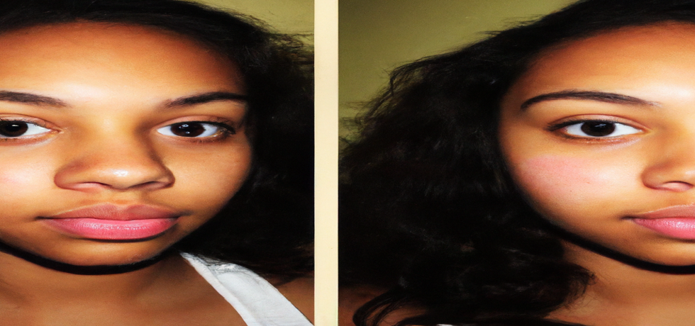 Unveiling the Truth About Pimple Patches