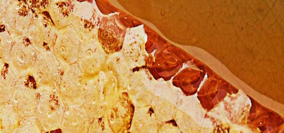 Winter Skin Savior: Your Guide to Glowing Skin on the Slopes