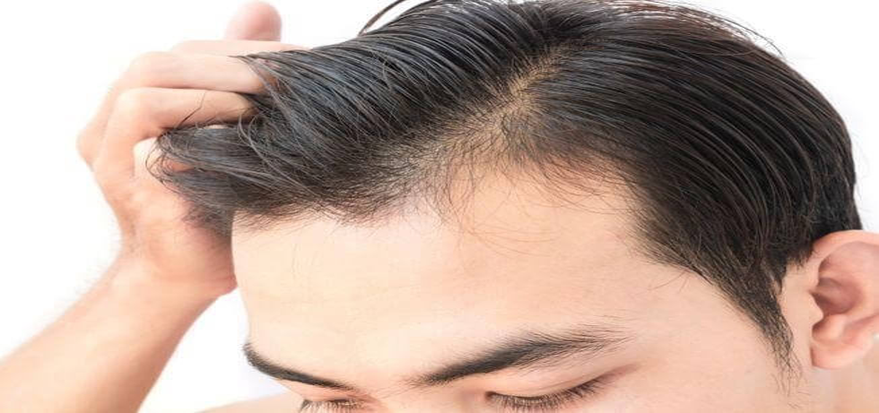 Your Guide to Effortless Hair Restoration