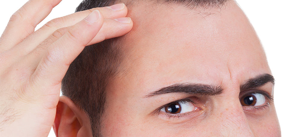 Temple Hair Loss: Expert Solutions